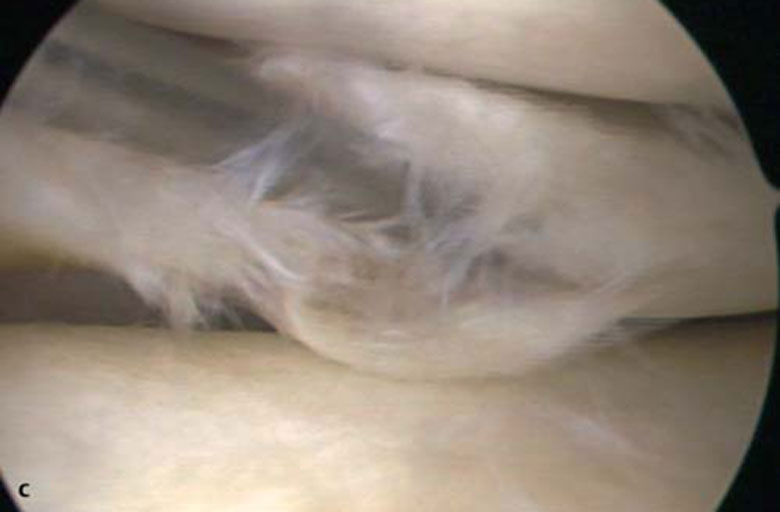 Arthroskopie – Campus Orthopädie Hamburg