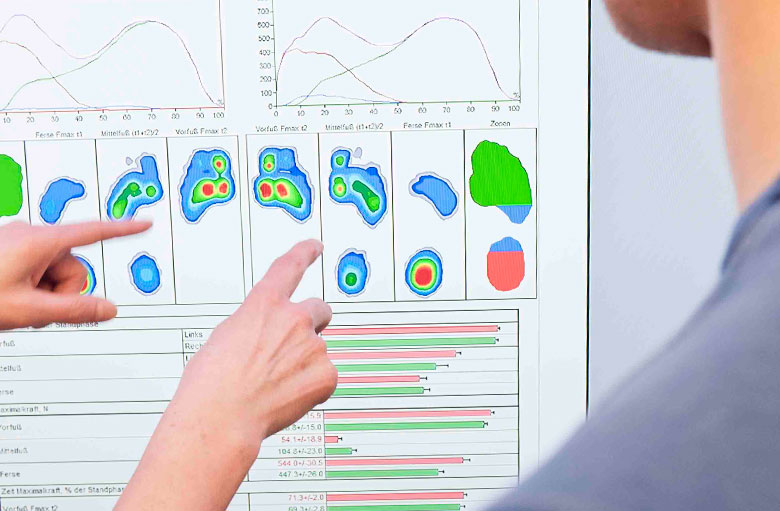 Bewegungsanalyse – Campus Orthopädie Hamburg