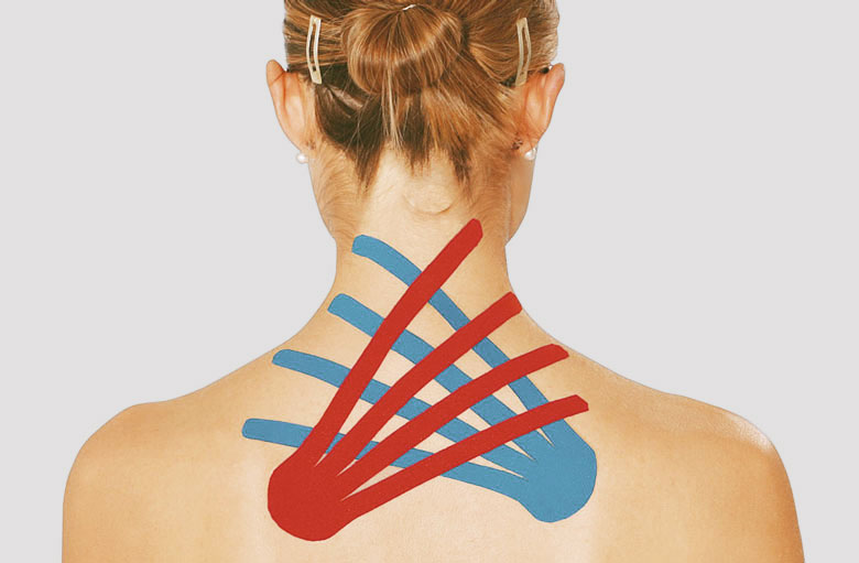 Kinesiotape – Campus Orthopädie Hamburg