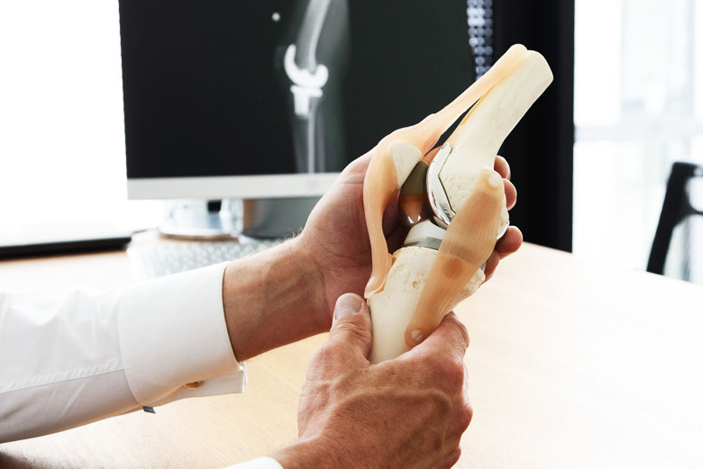 Knieendoprothese – Campus Orthopädie Hamburg