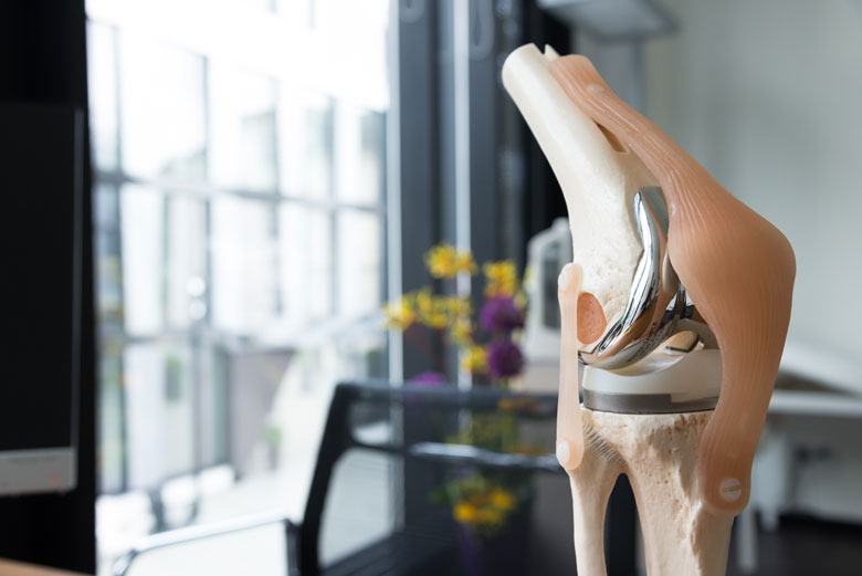 Knieprothese Knieendoprothese – Campus Orthopädie Hamburg