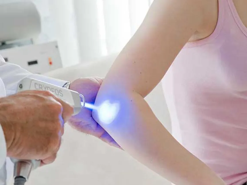 Kyro-Therapie mit Cyrofos